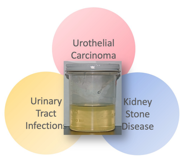 urine dx photo